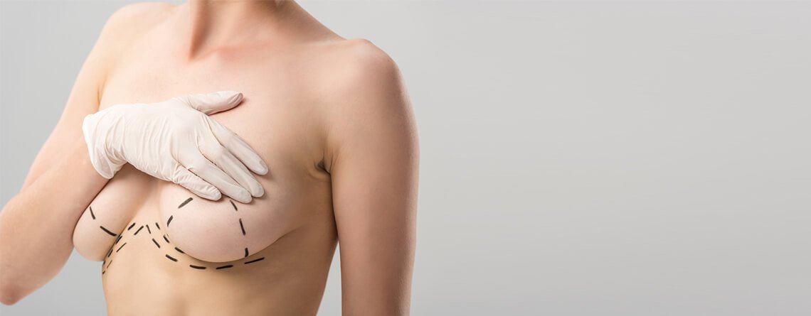 Exploring Different Techniques for Breast Lift Surgery