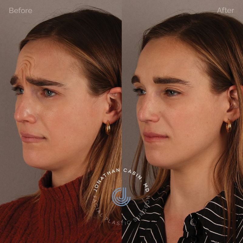 How Plastic Surgeons Help Achieve Natural-Looking Results