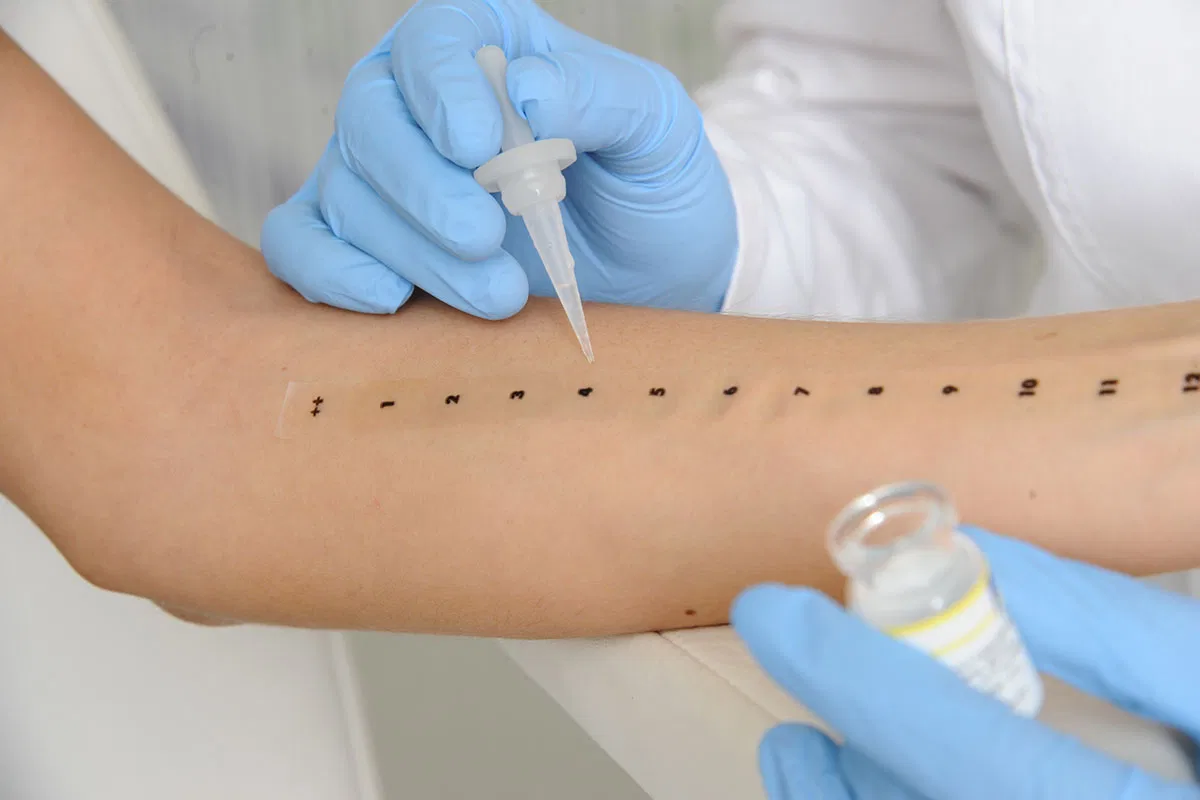 Understanding Allergy Testing: Types and Methods Explained